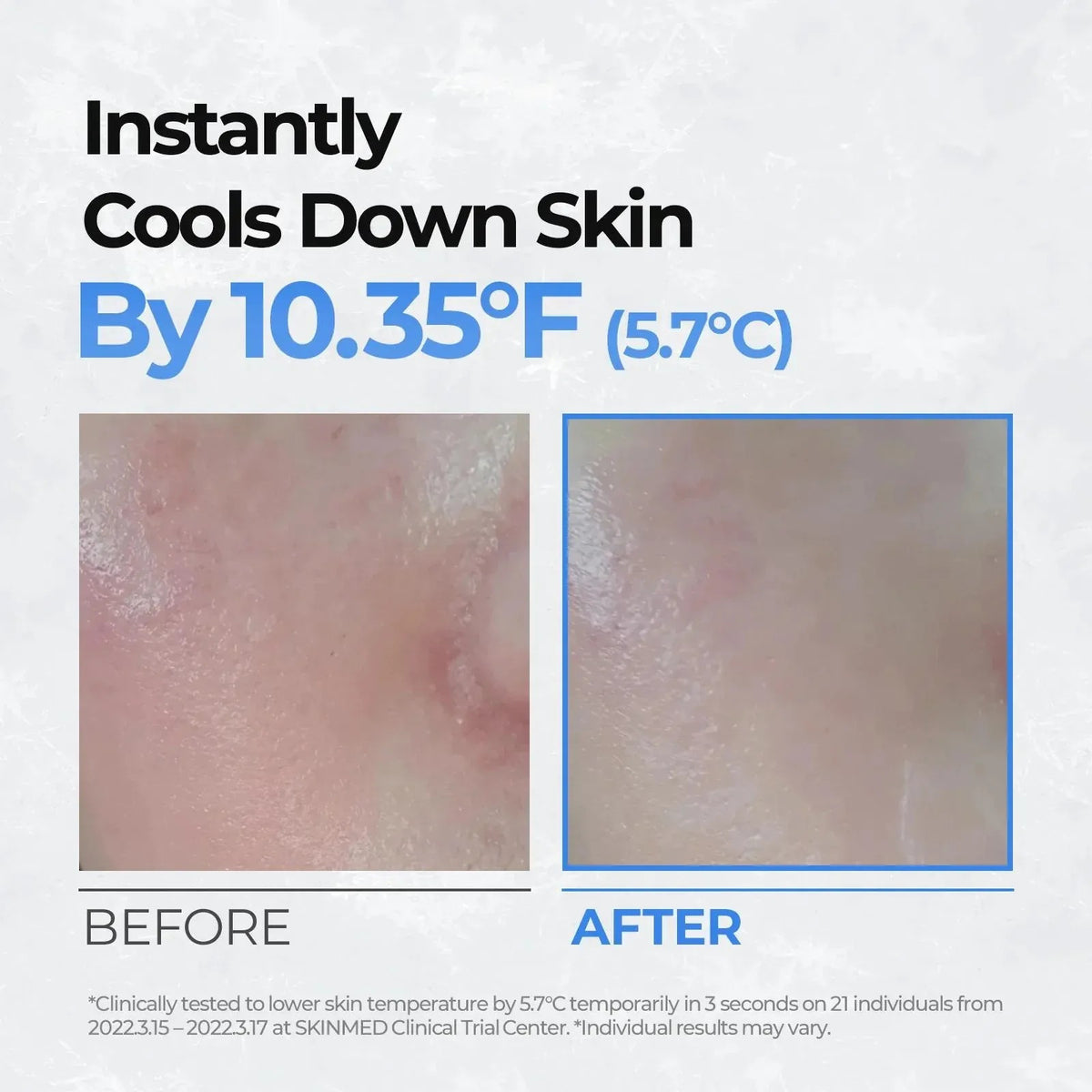 CellFusionC — [CellFusionC] Post Alpha Cooling Pad - 70 Pads_MX